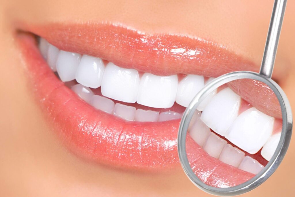 12 Proven Natural Home Remedies For Teeth Whitening