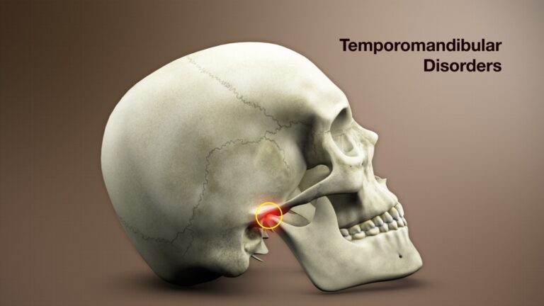 10 Ways to Help Manage Temporomandibular Joint Disorders - Medrot.com