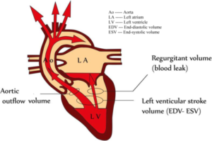 cause a reduced ejection fraction