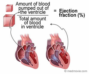 decreased left ventricular function 