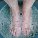 How to Remove Dry Skin from Your Feet Using Epsom Salt